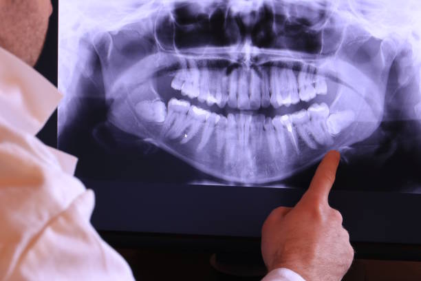Best Emergency Care for Gum Disease in Driggs, ID
